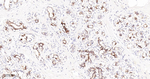 N-cadherin Antibody in Immunohistochemistry (Paraffin) (IHC (P))