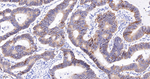 N-cadherin Antibody in Immunohistochemistry (Paraffin) (IHC (P))