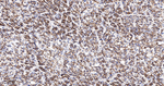 N-cadherin Antibody in Immunohistochemistry (Paraffin) (IHC (P))
