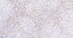N-cadherin Antibody in Immunohistochemistry (Paraffin) (IHC (P))