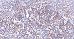 N-cadherin Antibody in Immunohistochemistry (Paraffin) (IHC (P))