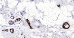 GCDFP-15 Antibody in Immunohistochemistry (Paraffin) (IHC (P))