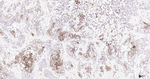 Cytokeratin Pan Type I/II Antibody in Immunohistochemistry (Paraffin) (IHC (P))