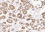 Cytokeratin Pan Type I/II Antibody in Immunohistochemistry (Paraffin) (IHC (P))