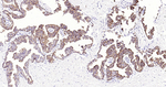 Cytokeratin Pan Type I/II Antibody in Immunohistochemistry (Paraffin) (IHC (P))