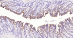 Cytokeratin Pan Type I/II Antibody in Immunohistochemistry (Paraffin) (IHC (P))