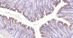 Cytokeratin Pan Type I/II Antibody in Immunohistochemistry (Paraffin) (IHC (P))