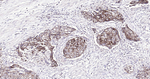 Cytokeratin Pan Type I/II Antibody in Immunohistochemistry (Paraffin) (IHC (P))