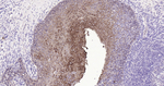 Cytokeratin Pan Type I/II Antibody in Immunohistochemistry (Paraffin) (IHC (P))