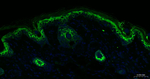 Cytokeratin Pan Type I/II Antibody in Immunohistochemistry (Paraffin) (IHC (P))