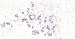Cytokeratin Pan Type I/II Antibody in Immunohistochemistry (Paraffin) (IHC (P))