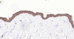 Cytokeratin Pan Type I/II Antibody in Immunohistochemistry (Paraffin) (IHC (P))