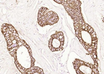 Cytokeratin Pan Type I/II Antibody in Immunohistochemistry (Paraffin) (IHC (P))