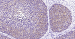 Cytokeratin Pan Type I/II Antibody in Immunohistochemistry (Paraffin) (IHC (P))