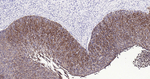 Cytokeratin Pan Type I/II Monoclonal Antibody (4C3)