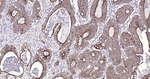 Cytokeratin Pan Type I/II Antibody in Immunohistochemistry (Paraffin) (IHC (P))