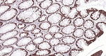 Cytokeratin Pan Type I/II Antibody in Immunohistochemistry (Paraffin) (IHC (P))