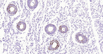 Cytokeratin Pan Type I/II Antibody in Immunohistochemistry (Paraffin) (IHC (P))