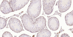 PMS2 Antibody in Immunohistochemistry (Paraffin) (IHC (P))