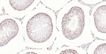 PMS2 Monoclonal Antibody (7A11)