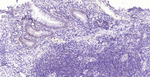 MLH1 Antibody in Immunohistochemistry (Paraffin) (IHC (P))
