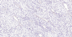 MLH1 Monoclonal Antibody (4A13)