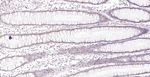 MLH1 Antibody in Immunohistochemistry (Paraffin) (IHC (P))
