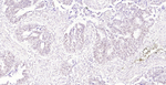 MLH1 Antibody in Immunohistochemistry (Paraffin) (IHC (P))