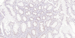 MLH1 Antibody in Immunohistochemistry (Paraffin) (IHC (P))