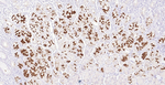 MUC6 Antibody in Immunohistochemistry (Paraffin) (IHC (P))