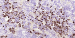 ACTH Monoclonal Antibody (7D13)