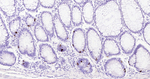 Chromogranin A Antibody in Immunohistochemistry (Paraffin) (IHC (P))