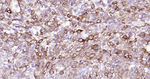 Cytokeratin 14 Antibody in Immunohistochemistry (Paraffin) (IHC (P))
