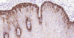Cytokeratin 14 Antibody in Immunohistochemistry (Paraffin) (IHC (P))