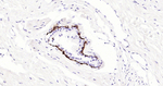 Cytokeratin 14 Antibody in Immunohistochemistry (Paraffin) (IHC (P))