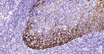 Cytokeratin 14 Antibody in Immunohistochemistry (Paraffin) (IHC (P))