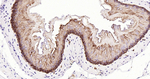 Cytokeratin 14 Antibody in Immunohistochemistry (Paraffin) (IHC (P))