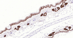 Cytokeratin 14 Antibody in Immunohistochemistry (Paraffin) (IHC (P))