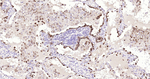 NAPSA Antibody in Immunohistochemistry (Paraffin) (IHC (P))