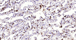NAPSA Antibody in Immunohistochemistry (Paraffin) (IHC (P))