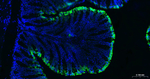 Cytokeratin 20 Antibody in Immunohistochemistry (Paraffin) (IHC (P))