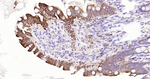 Cytokeratin 20 Antibody in Immunohistochemistry (Paraffin) (IHC (P))