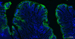 Cytokeratin 20 Antibody in Immunohistochemistry (Paraffin) (IHC (P))