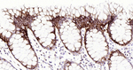 Cytokeratin 20 Antibody in Immunohistochemistry (Paraffin) (IHC (P))