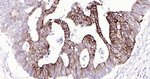 Cytokeratin 20 Antibody in Immunohistochemistry (Paraffin) (IHC (P))