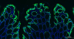 Cytokeratin 20 Antibody in Immunohistochemistry (Paraffin) (IHC (P))