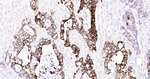 Cytokeratin 20 Antibody in Immunohistochemistry (Paraffin) (IHC (P))