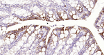 Cytokeratin 20 Antibody in Immunohistochemistry (Paraffin) (IHC (P))