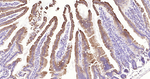 Cytokeratin 20 Antibody in Immunohistochemistry (Paraffin) (IHC (P))