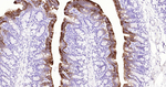 Cytokeratin 20 Antibody in Immunohistochemistry (Paraffin) (IHC (P))